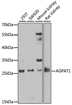 a09272 agpat1 primary antiboties wb testing 1