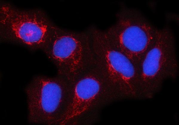 a09276 3 ndufa4 primary antibodies if testing 5