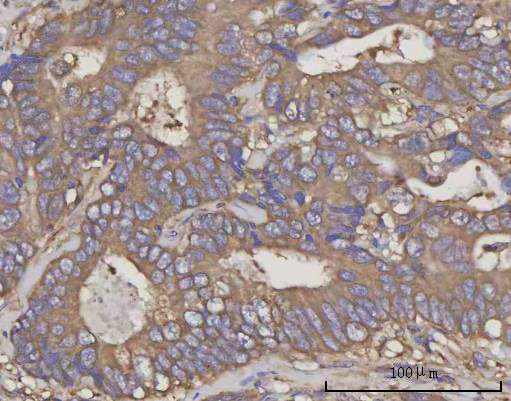  IHC analysis of NDUFA4 using anti-NDUFA4 antibody (A09276-3)