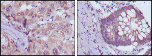 a09277 bdh1 primary antibodies ihc testing 1
