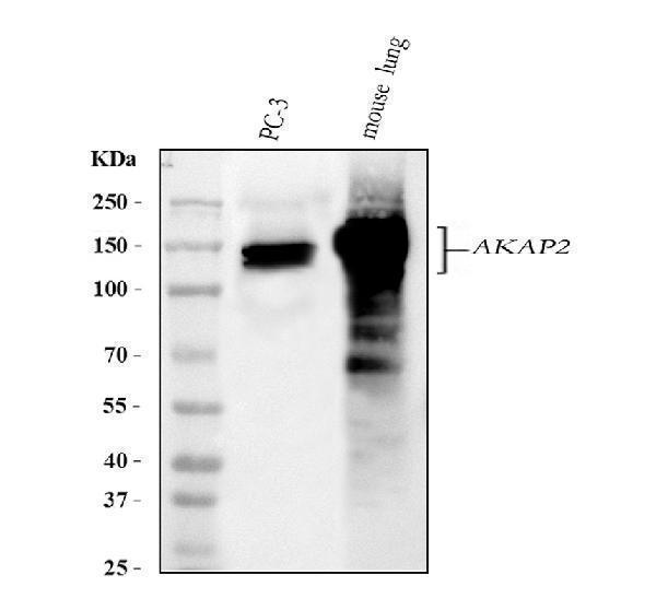  Western blot analysis of AKAP2 using anti-AKAP2 antibody (A09279)
