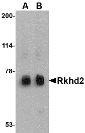 Western blot analysis of Rkhd2 in rat heart tissue lysate with Rkhd2 antibody at (A) 0