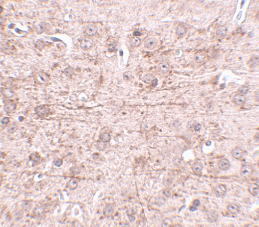 a09282 zbtb1 primary antibodies ihc testing 2