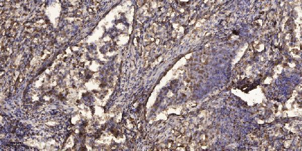 a09284 myo16 primary antibodies ihc testing 1