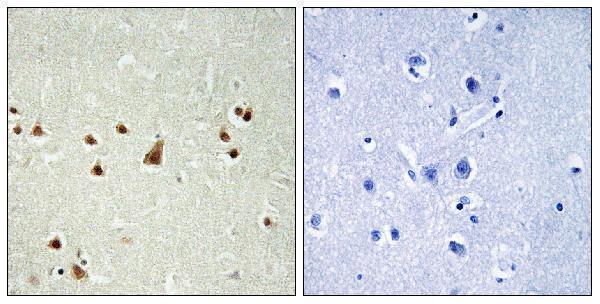 a09289 1 ankrd26 primary antibodies ihc testing 1