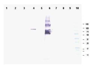 a09289 ankrd26 primary antibodies wb testing 1