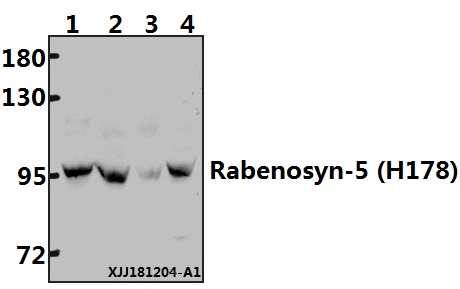 Western blot (WB) analysis of Rabenosyn-5 (H178) polyclonal antibody at 1:500 dilution
Lane1:Myla2059 whole cell lysate(40ug)
Lane2:HUT78 whole cell lysate(40ug)
Lane3:PC12 whole cell lysate(40ug)
Lane4:Jurkat whole cell lysate(40ug)