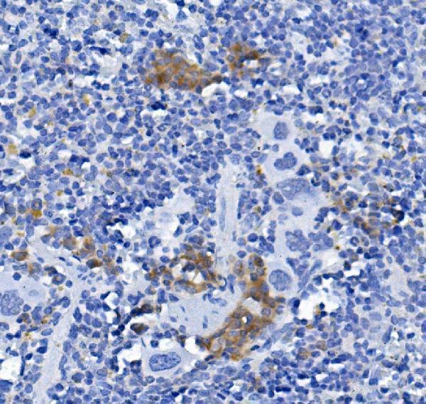 a09292 2 cd72 primary antibodies ihc testing 2