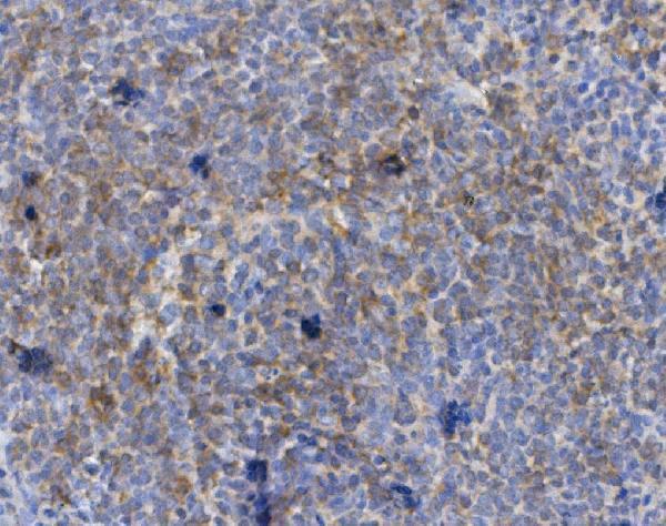 a09292 2 cd72 primary antibodies ihc testing 3