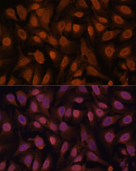 Immunofluorescence analysis of U-2 OS cells using ZNF131 antibody  at dilution of 1:100