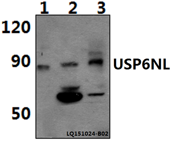 a09295 1 usp6nl primary antiboties wb testing 1