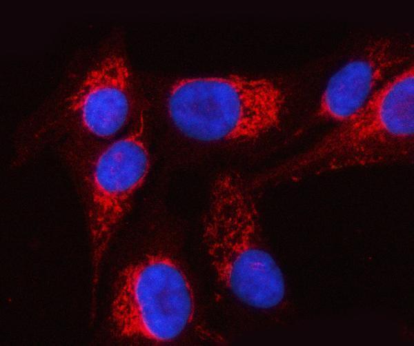 a09297 rmdn3 primary antibodies if testing 6