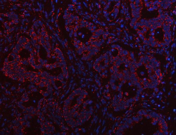 a09297 rmdn3 primary antibodies if testing 7