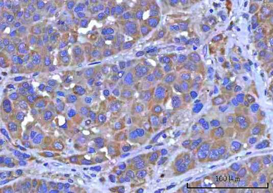 a09297 rmdn3 primary antibodies ihc testing 2