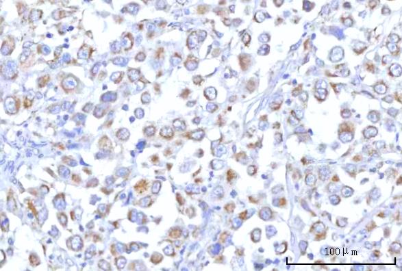 a09297 rmdn3 primary antibodies ihc testing 3
