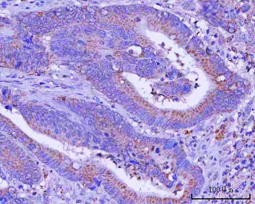 a09297 rmdn3 primary antibodies ihc testing 4