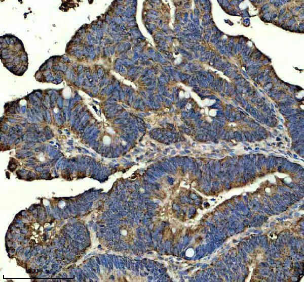 a09298 1 gpaa1 primary antibodies ihc testing 2