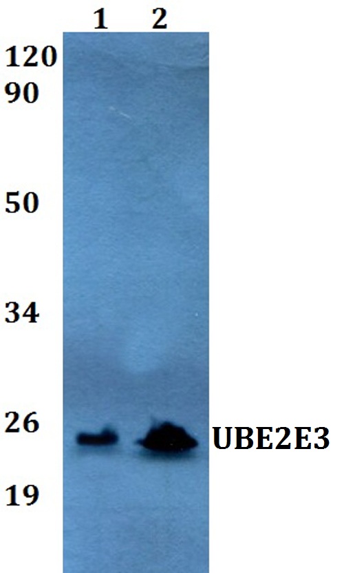 Western blot (WB) analysis of UBE2E3 polyclonal antibody at 1:500 dilution
Lane1:A549 whole cell lysate
Lane2:PC12 whole cell lysate 
