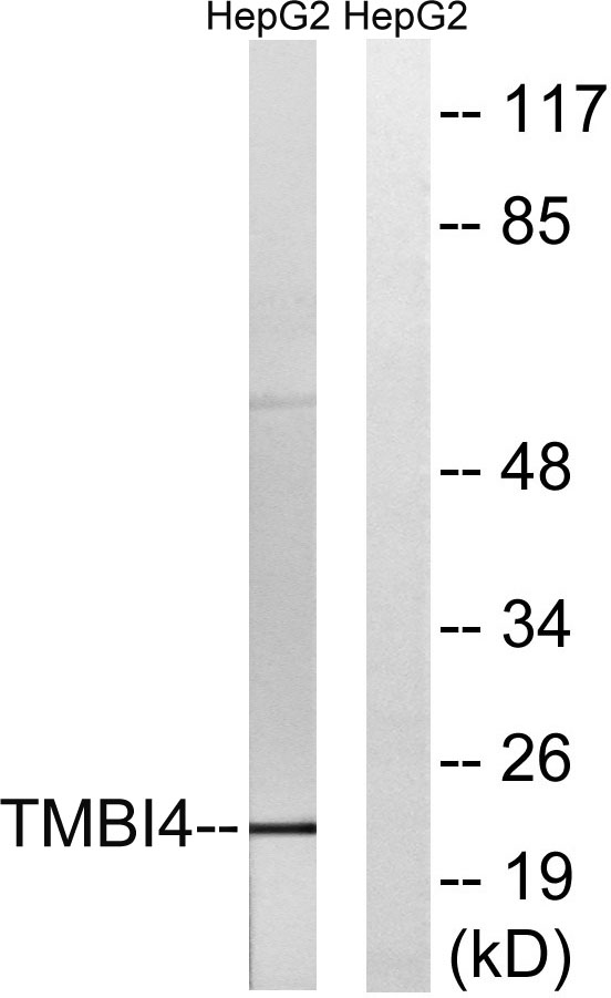Western blot analysis of lysates from HepG2 cells, using TMBIM4 Antibody