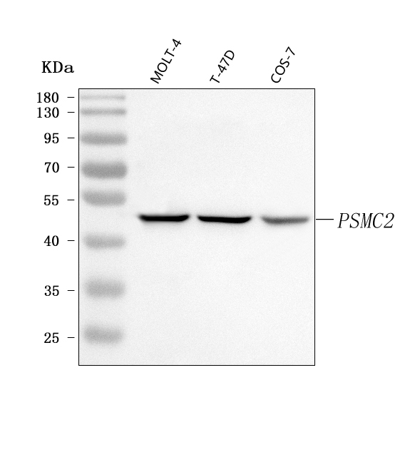  Western blot analysis of PSMC2 using anti-PSMC2 antibody (A09306-1)