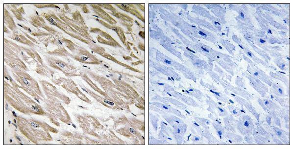 Immunohistochemistry analysis of paraffin-embedded human heart, using PPP1R2 (Phospho-Ser120+Ser121) Antibody