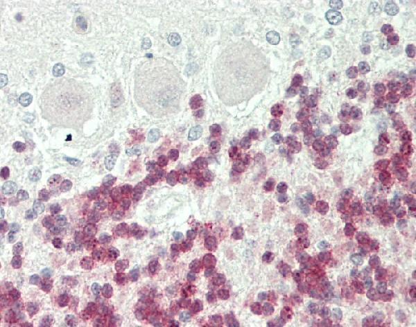 Formalin-fixed and paraffin-embedded H