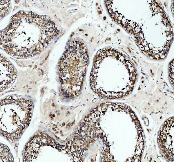 a09309 gmpr primary antibodies ihc testing 1
