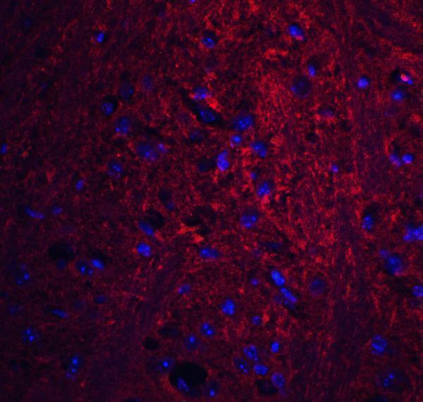 a09313 pion primary antibodies if testing 5