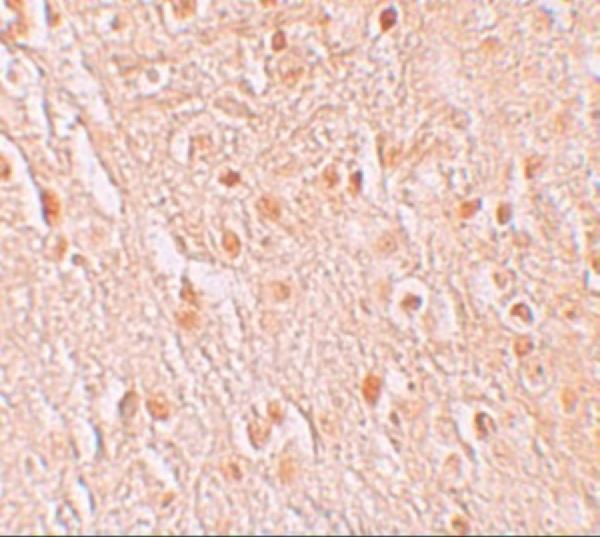 a09313 pion primary antibodies ihc testing 2