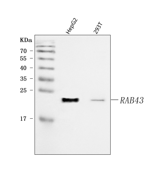 Western blot analysis of RAB43 using anti-RAB43 antibody (A09315-1)