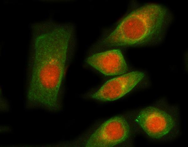 a09317 1 rngtt primary antibodies if testing 7