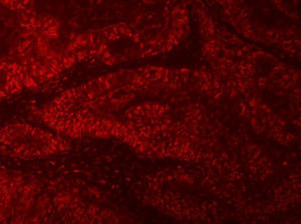 a09317 1 rngtt primary antibodies if testing 8