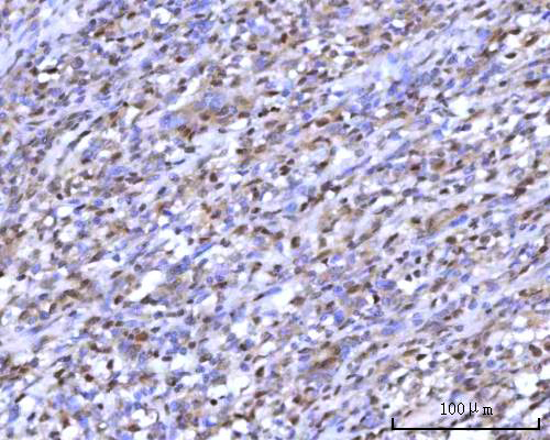  IHC analysis of RNGTT using anti-RNGTT antibody (A09317-1)