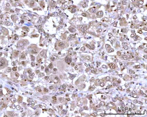 IHC analysis of RNGTT using anti-RNGTT antibody (A09317-1)