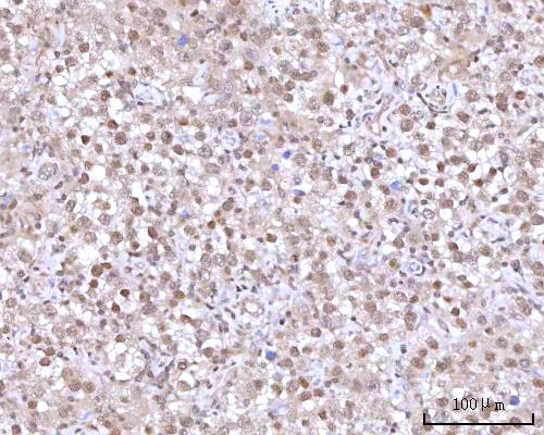 a09317 1 rngtt primary antibodies ihc testing 6