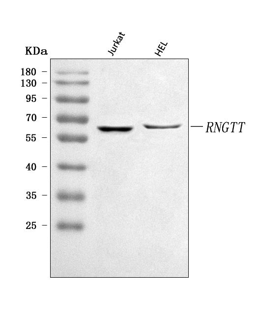  Western blot analysis of RNGTT using anti-RNGTT antibody (A09317-1)