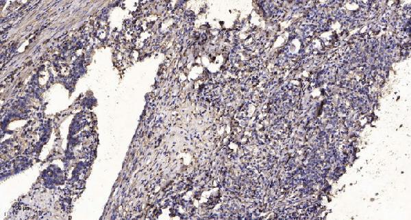 a09318 rab11fip4 primary antibodies ihc testing 1