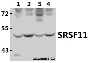 Western blot (WB) analysis of SRSF11 Antibody at 1:500 dilution
Lane1:CT26 whole cell lysate(40ug)
Lane2:H9C2 whole cell lysate(40ug)
Lane3:SGC7901 whole cell lysate(40ug)
Lane4:A549 whole cell lysate(40ug)