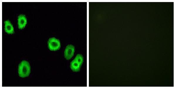 a09327 1 gpr18 primary antibodyes if testing 2