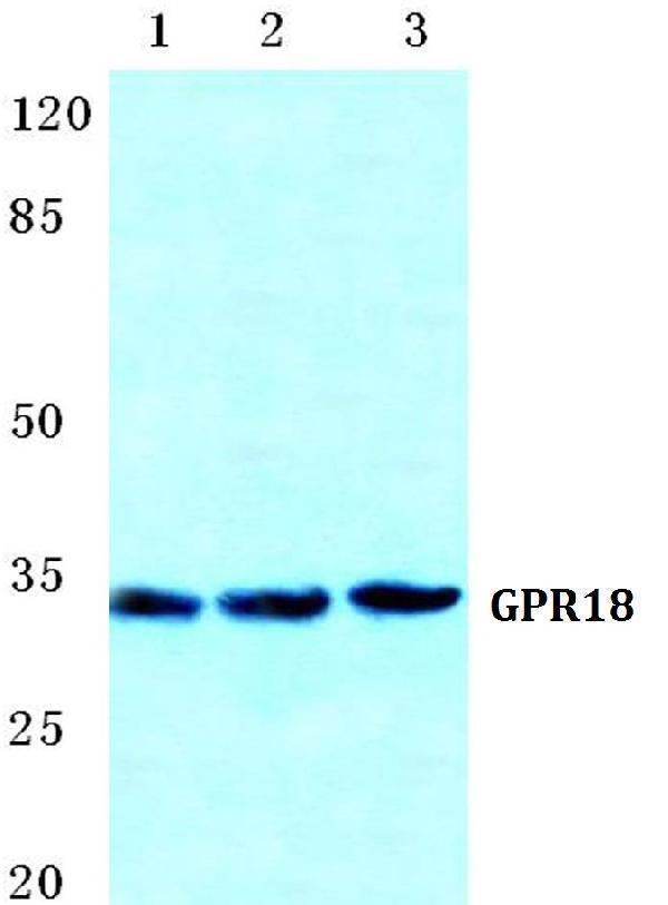 Western blot (WB) analysis of GPR18 polyclonal antibody at 1:500 dilution
Lane1:HEK293T cell lysate
Lane2:sp2/0 cell lysate
Lane3:H9C2 cell lysate