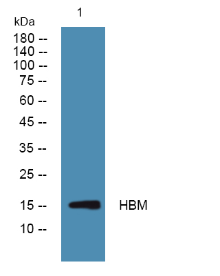 Western blot analysis of lysates from HCT116 cells, primary antibody was diluted at 1:1000, 4°over night
