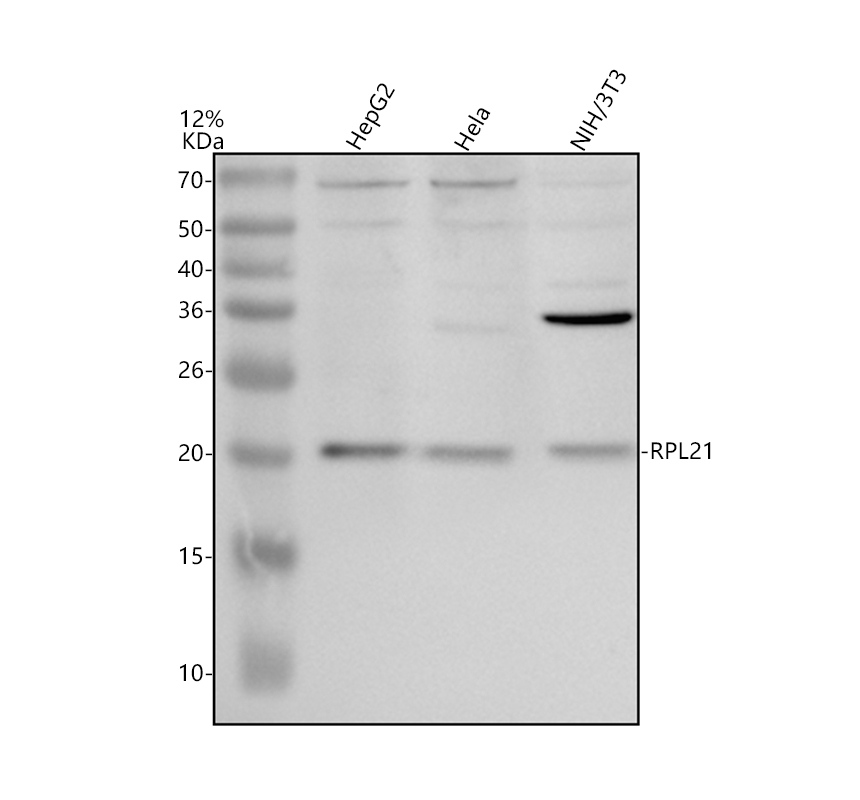 Western blot analysis of RPL21 using anti-RPL21 antibody (A09333-1)