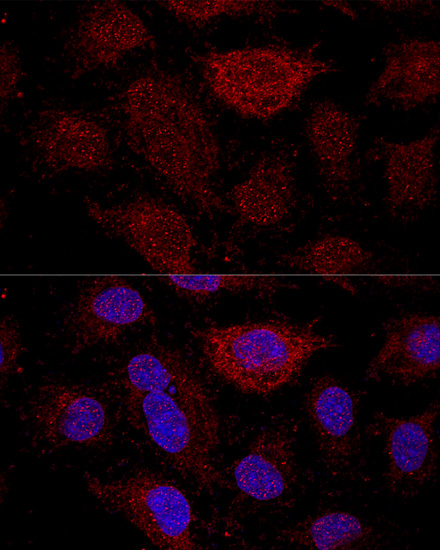 a09333 rpl21 primary antiboties if testing 3