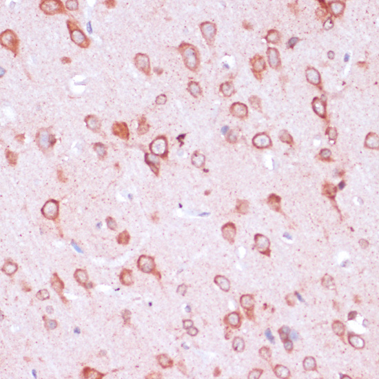 a09333 rpl21 primary antiboties ihc testing 2