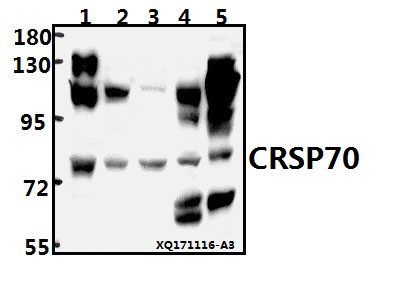 Western blot (WB) analysis of CRSP70 (S7) pAb at 1:500 dilution
Lane1:HEK293T whole cell lysate(40ug)
Lane2:PC3 whole cell lysate(40ug)
Lane3:K562 whole cell lysate(40ug)
Lane4:The Brain tissue lysate of Rat(40ug)
Lane5:The Kidney tissue lysate of Mouse(40ug)
