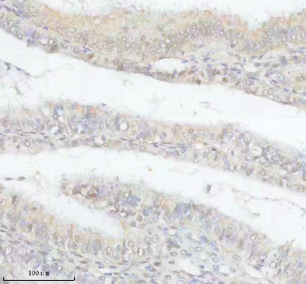 IHC analysis of DNPEP using anti-DNPEP antibody (A09344)