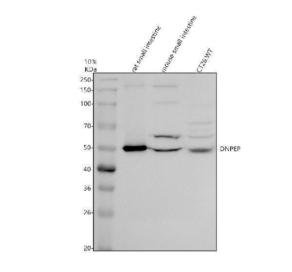 Western blot analysis of DNPEP using anti-DNPEP antibody (A09344)