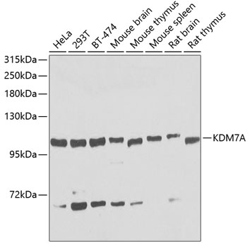 a09346 kdm7a primary antiboties wb testing 1