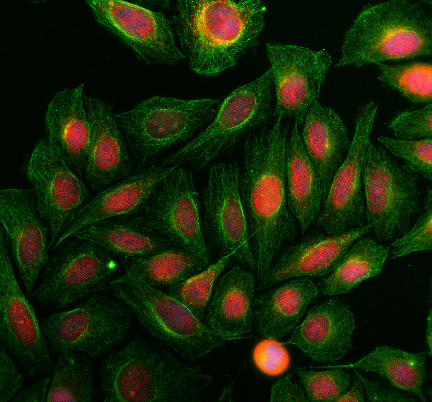 a09348 1 abca5 primary antibodies if testing 1