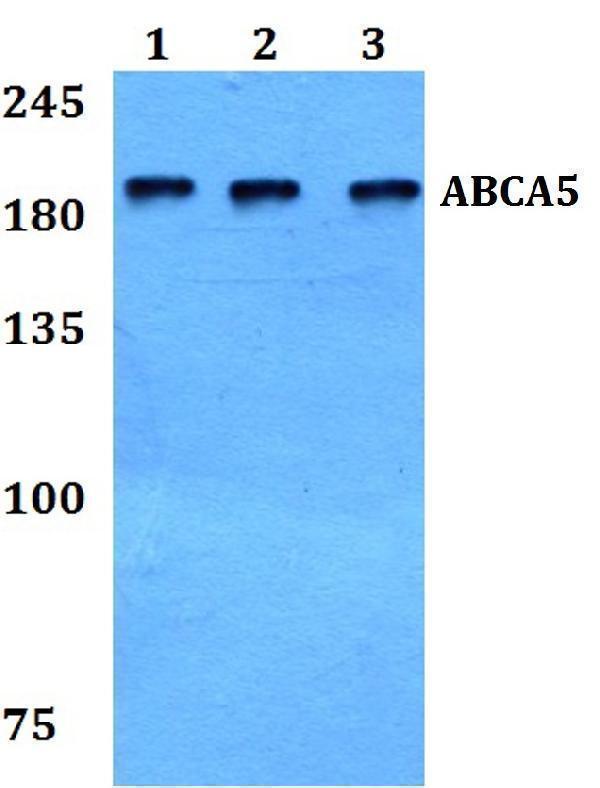 Western blot (WB) analysis of ABCA5 polyclonal antibody at 1:500 dilution
Lane1:HepG2 whole cell lysate
Lane2:NIH-3T3 whole cell lysate
Lane3:H9C2 whole cell lysate